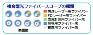 複合型の種類